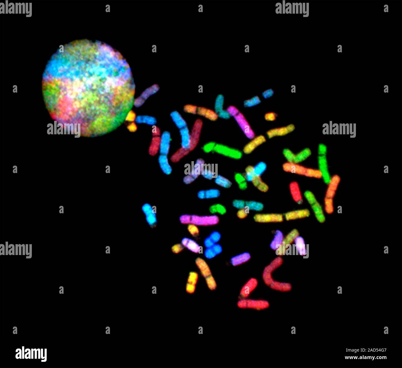 Chromosomes. Normal human chromosomes visualized by a technique called