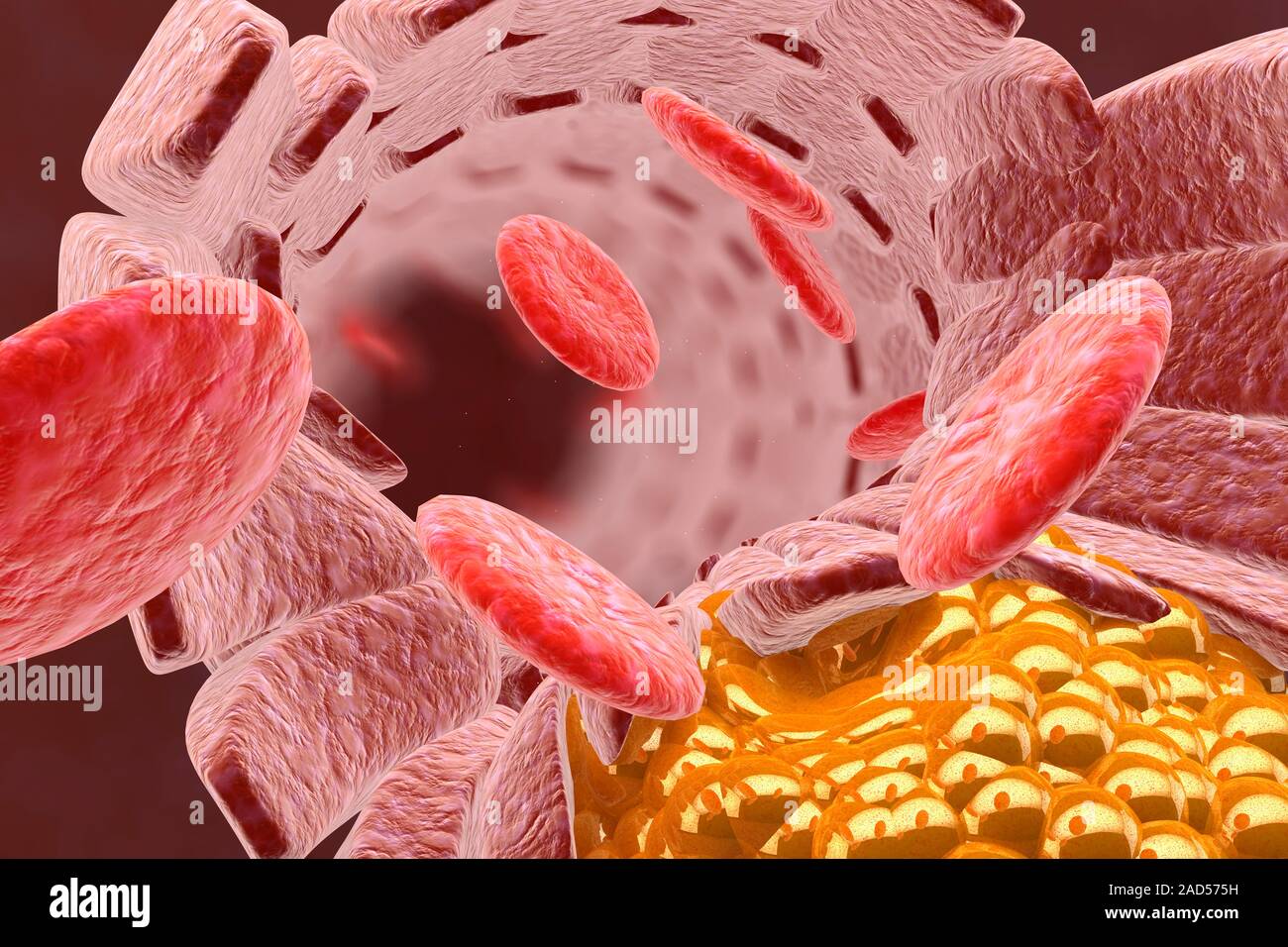 Cholesterol and red blood cells, illustration. Cholesterol is a lipid ...