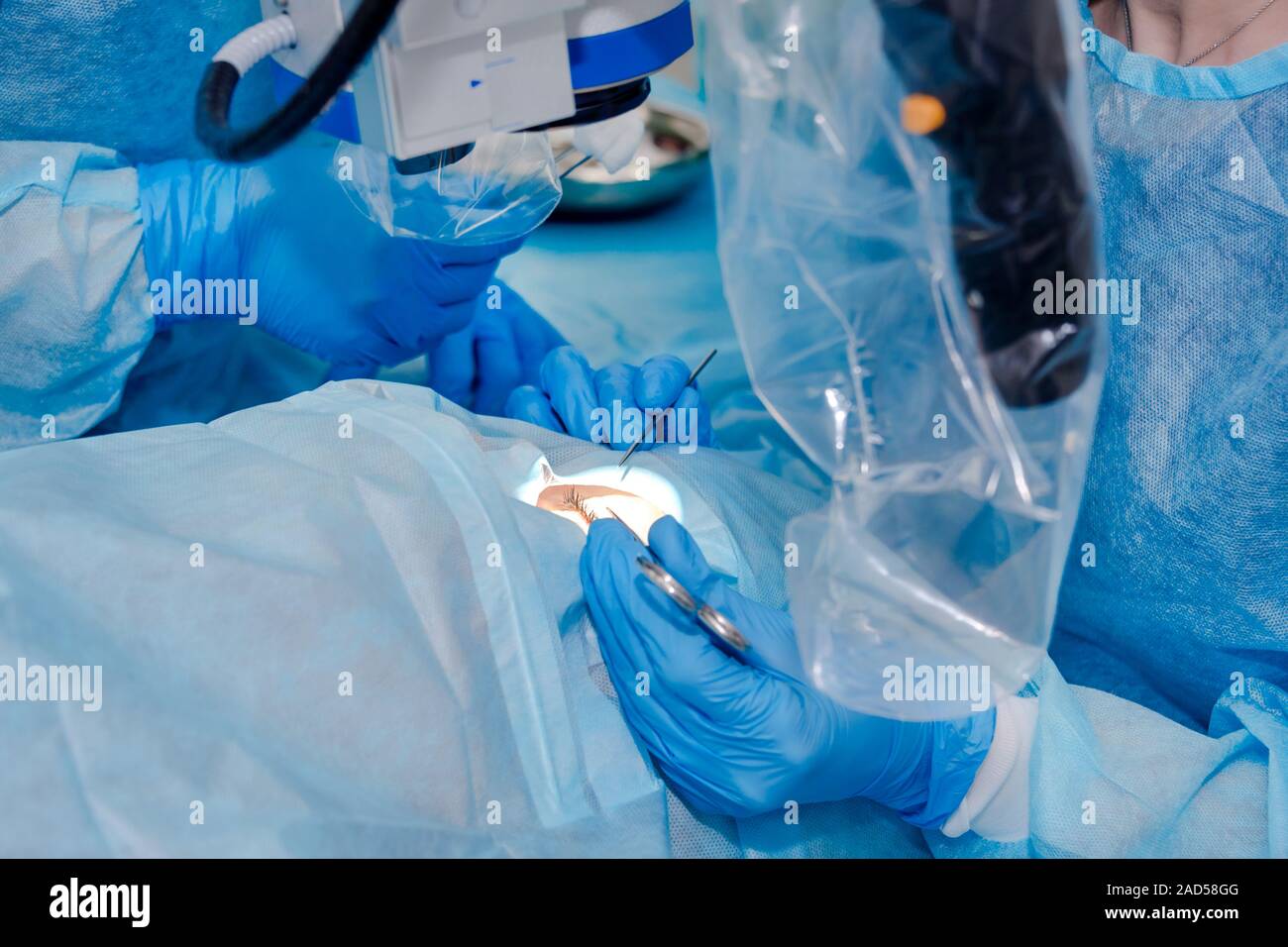 Close up of surgery team operating. The operation on the eye. Cataract