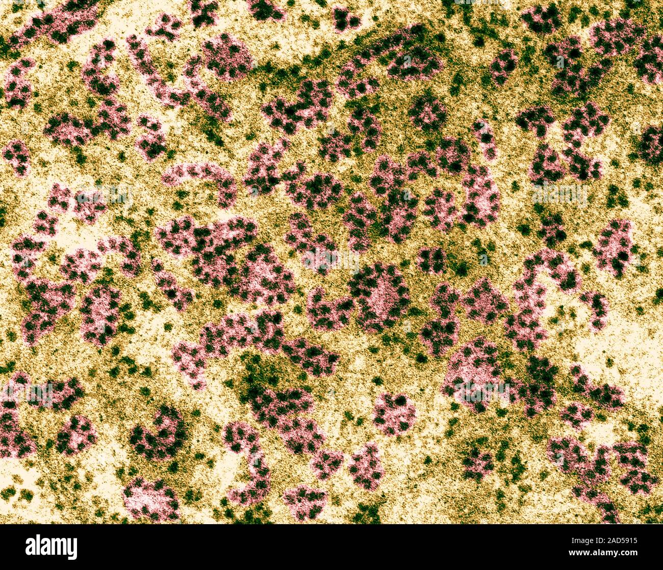 Ribosomes and polyribosomes (liver cell - hepatocyte), coloured ...