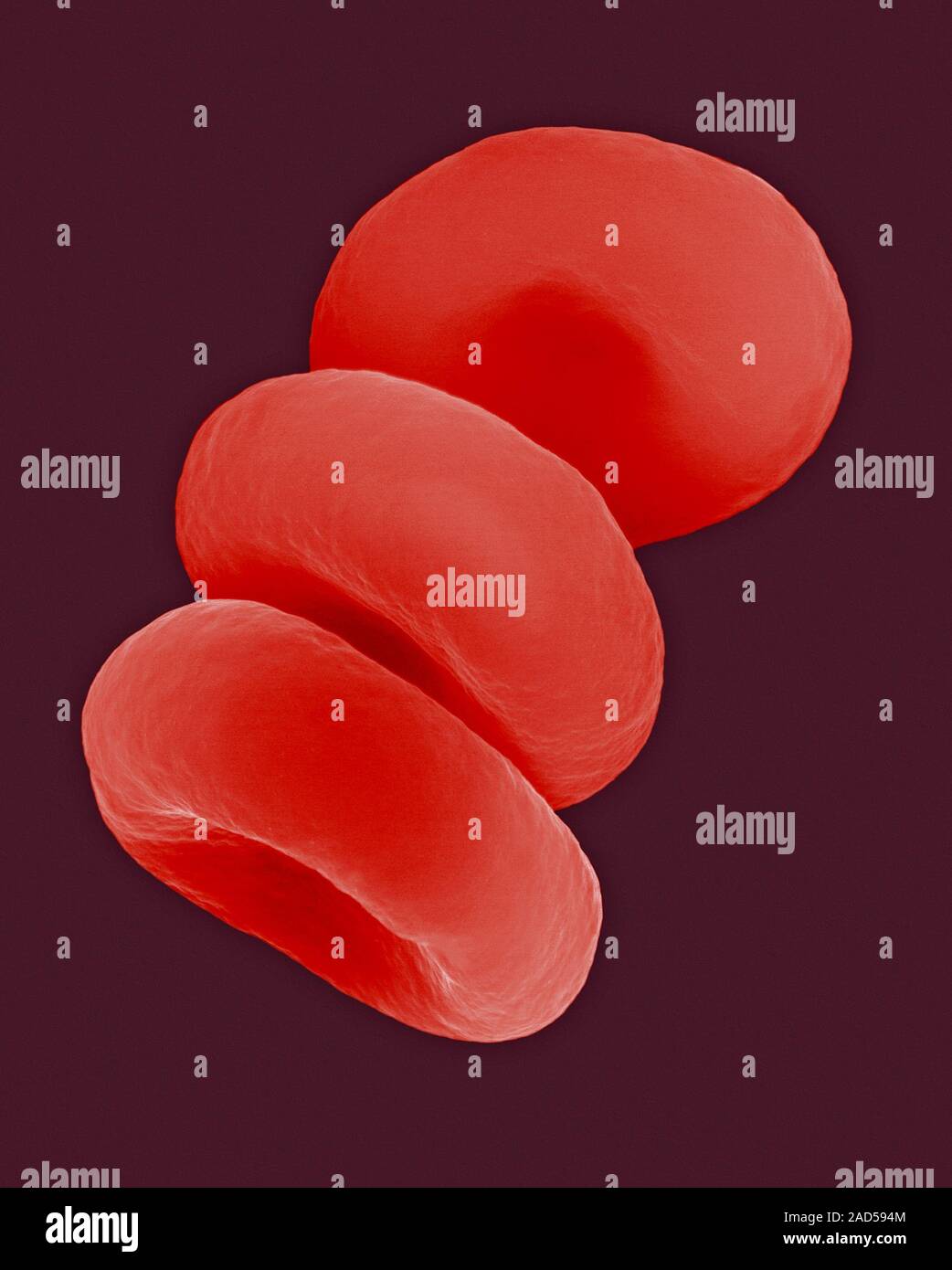 Red blood cells in the Rouleau formation, coloured scanning electron