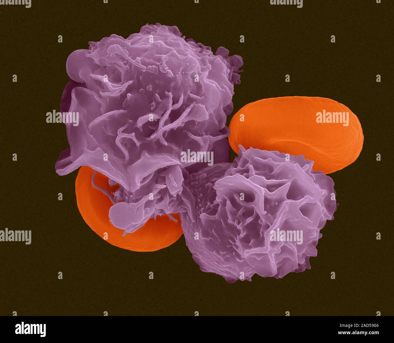 Granulocytic white blood cells (neutrophils) and red blood cells