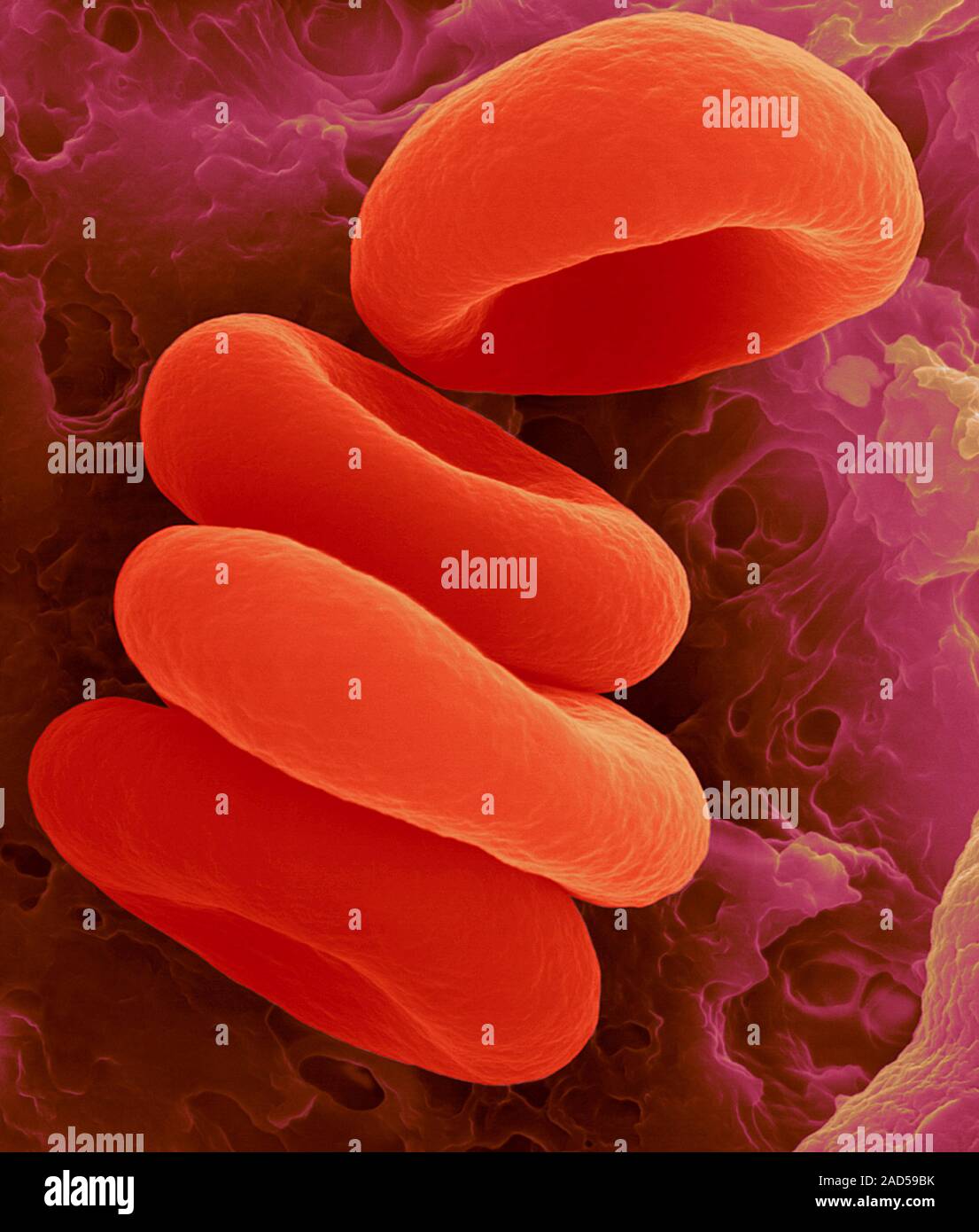 Red blood cells in the Rouleau formation, coloured scanning electron