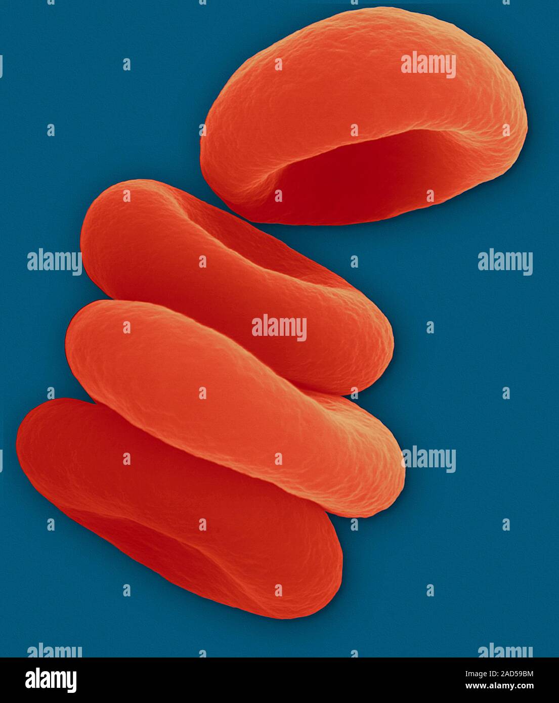 Red blood cells in the Rouleau formation, coloured scanning electron