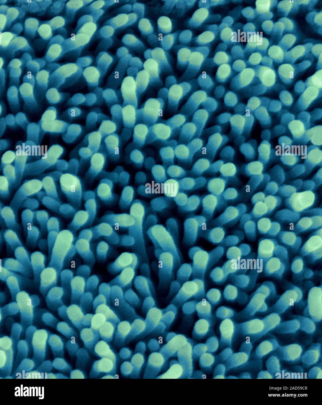 Nasopharynx surface, coloured scanning electron micrograph (SEM). Shown ...