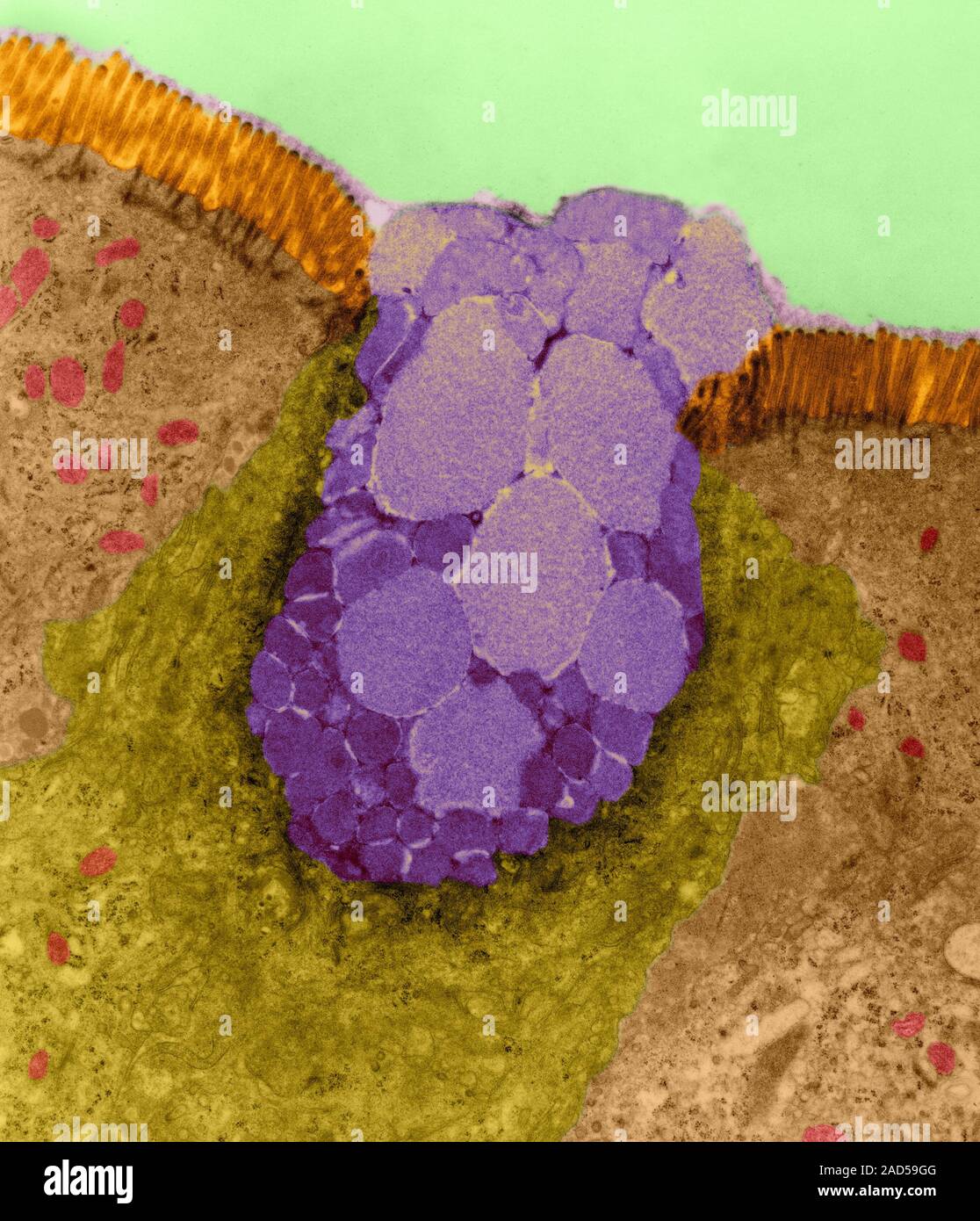 Goblet cell in the lining of the nasal epithelium, coloured