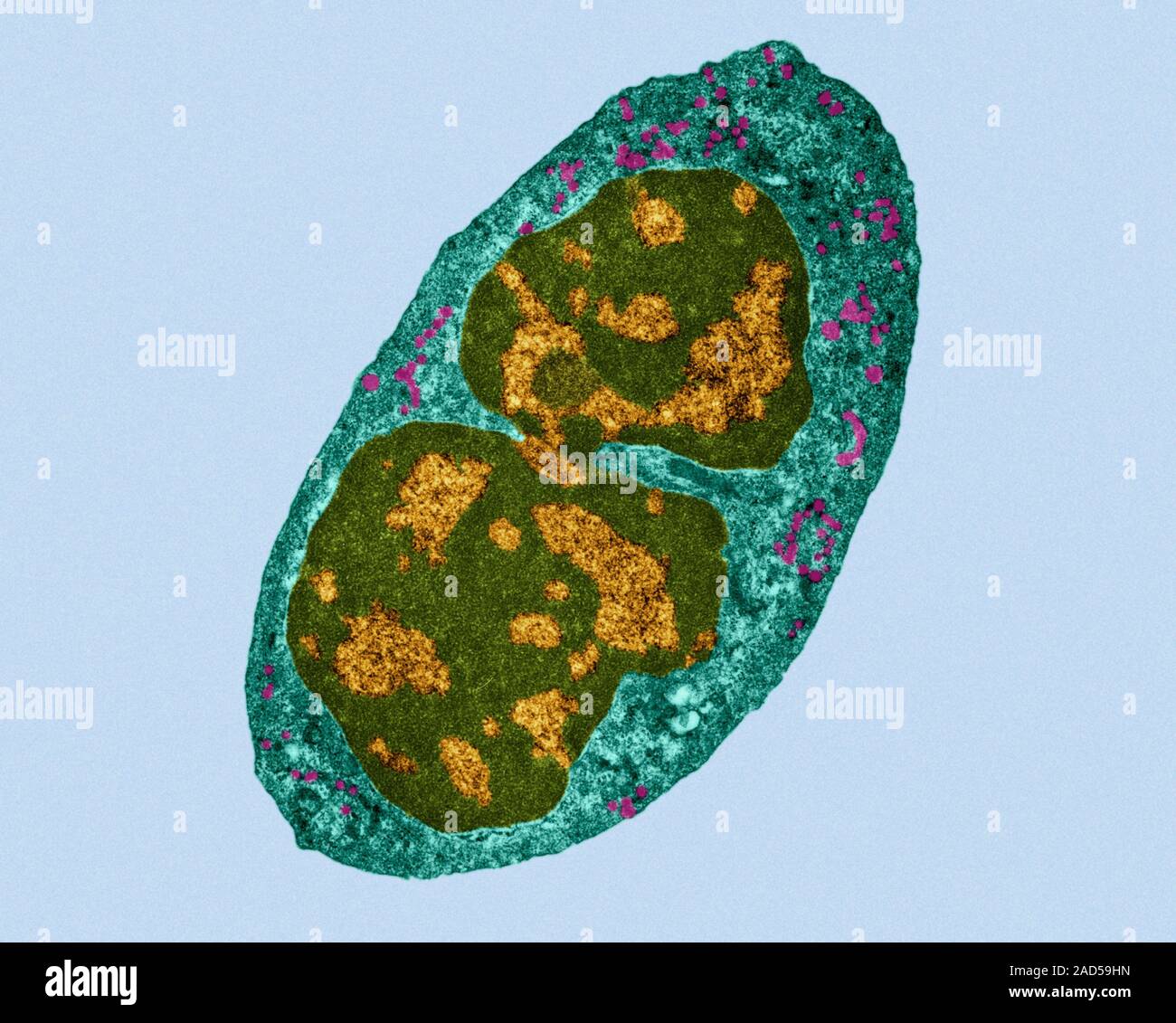 Human neutrophil (a type of granulocyte), coloured transmission