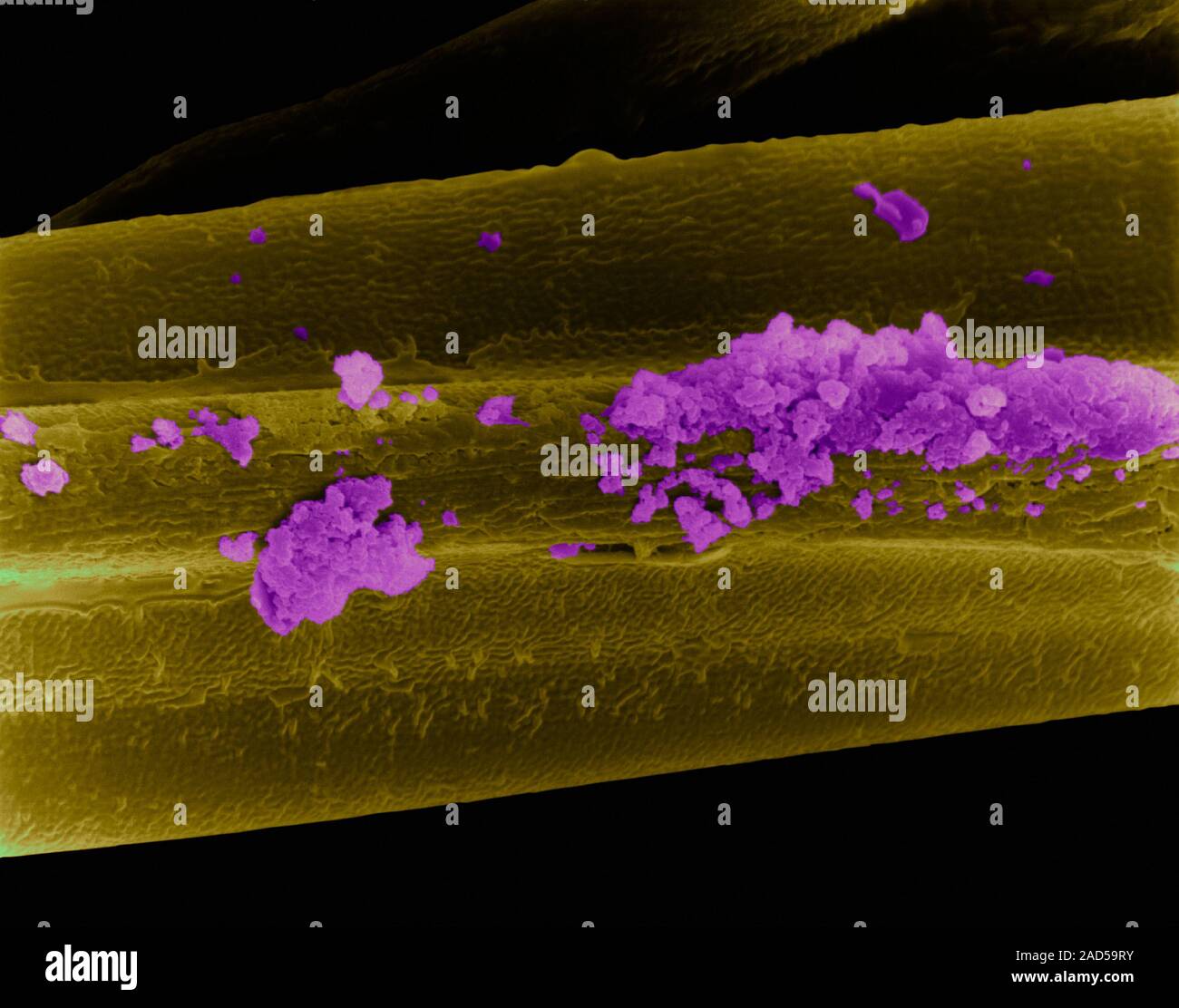 Tobacco smoke particles on the surface of a cigarette filter fibre