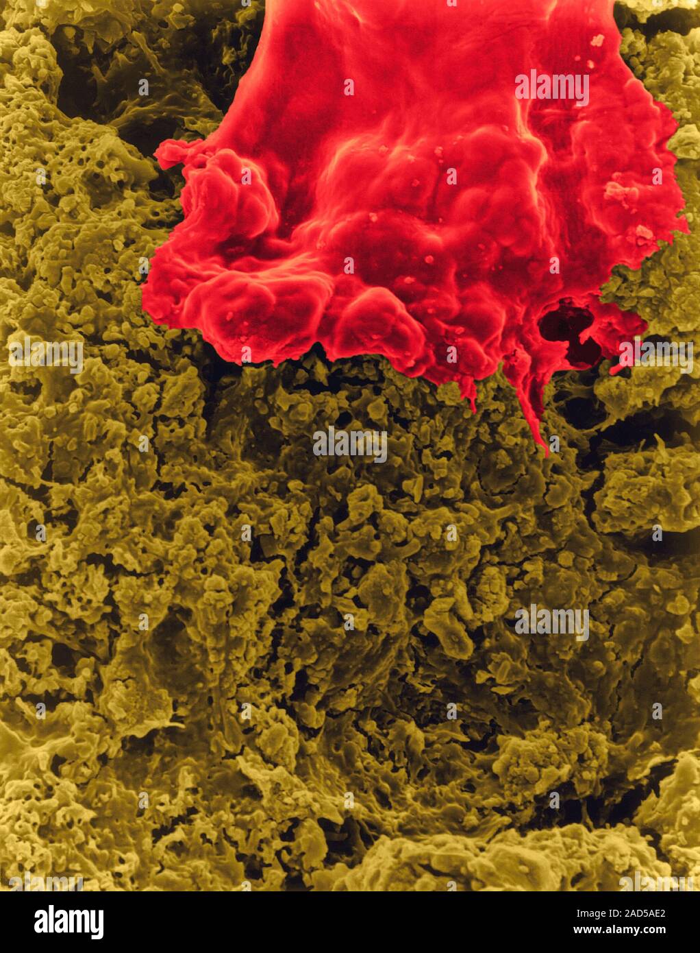 Human tooth with an accumulation of bacterial plaque (smooth areas) and