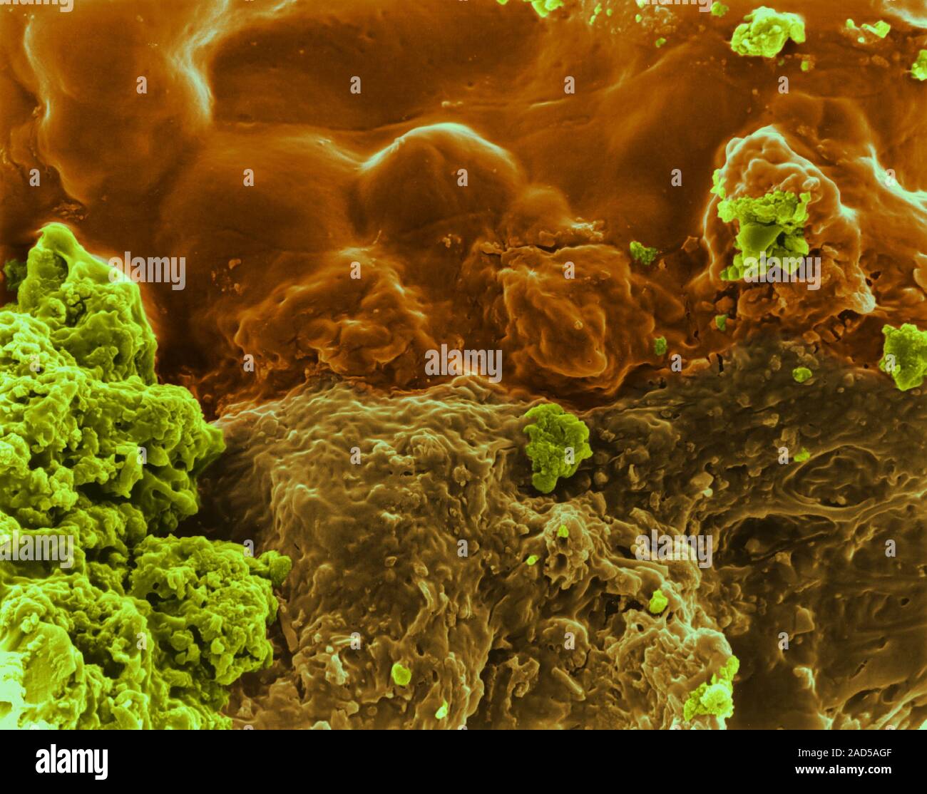 Human tooth with an accumulation of bacterial plaque (smooth areas) and