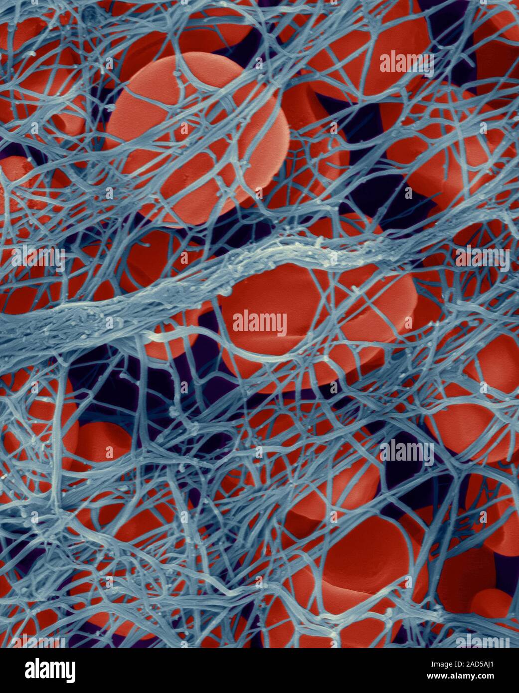 фибрин капилляры. фибрин капилляры. фибрин свертываемость. фибрин капилляры. микроциркуляция компоненты.