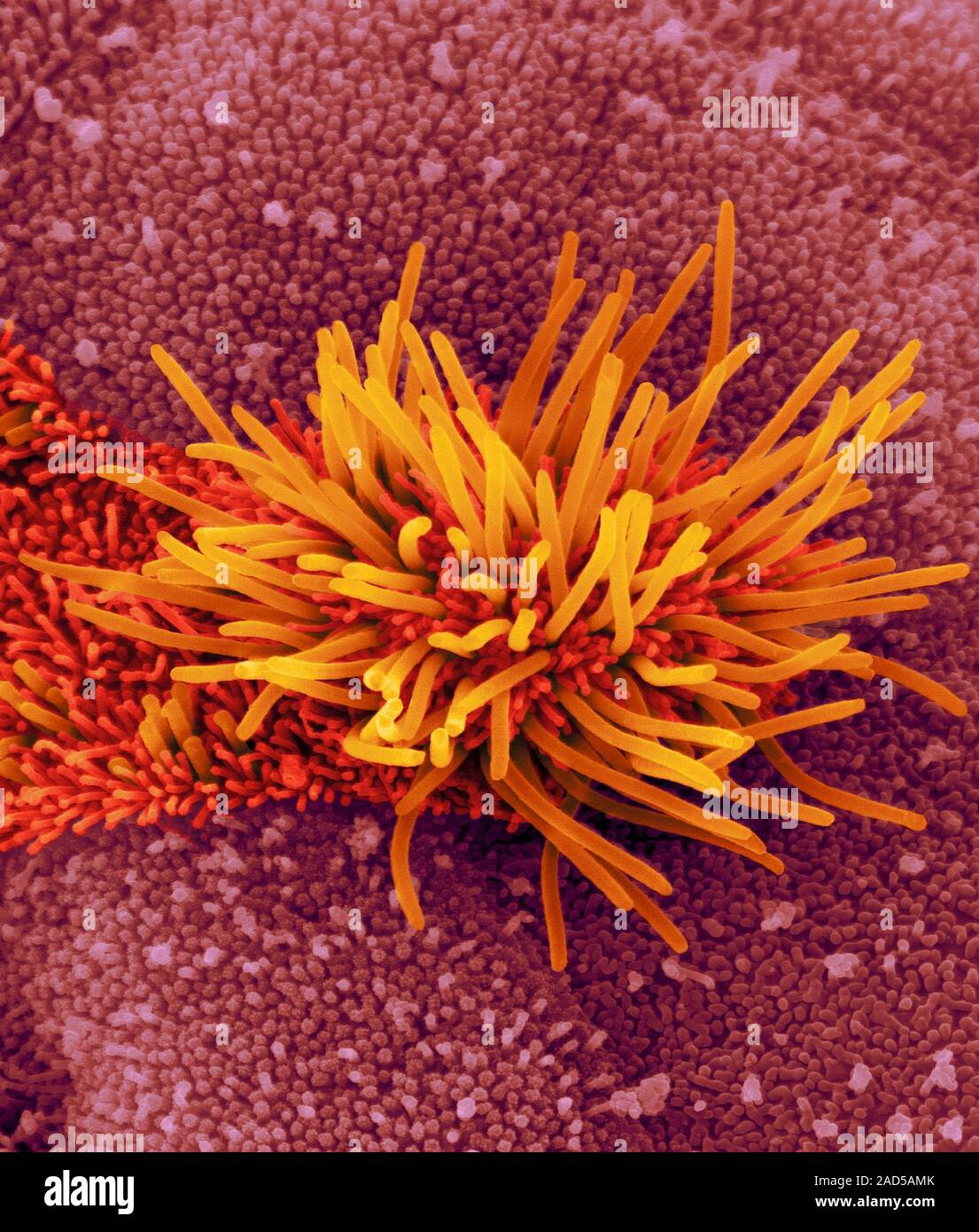 Nasopharynx surface, coloured scanning electron micrograph (SEM). Seen ...
