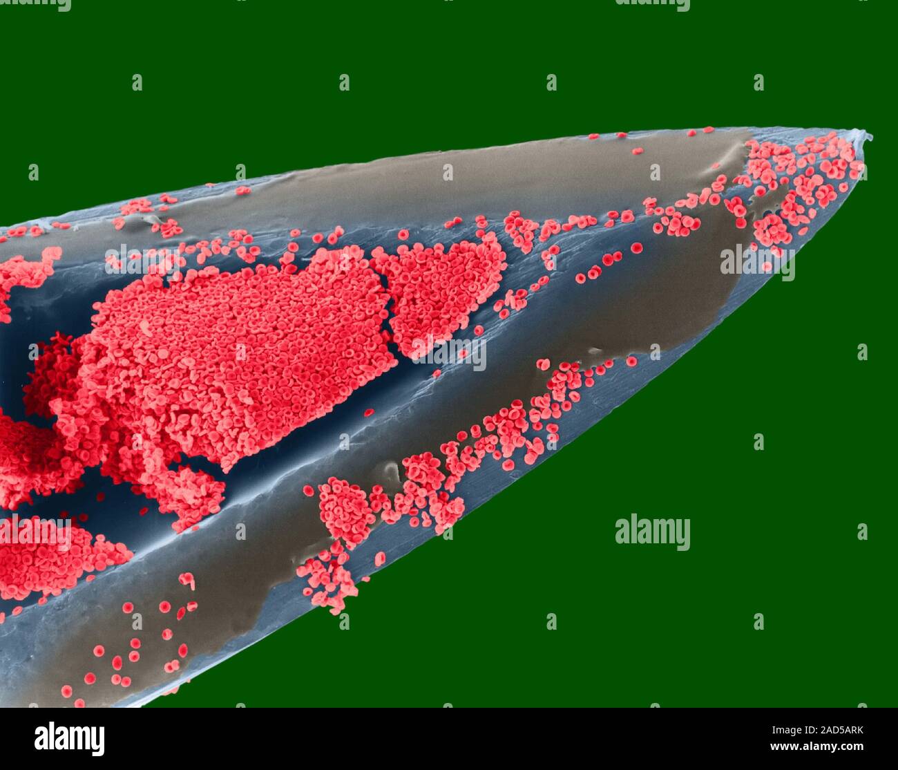 Hypodermic needle (26 gauge) and human blood, coloured scanning