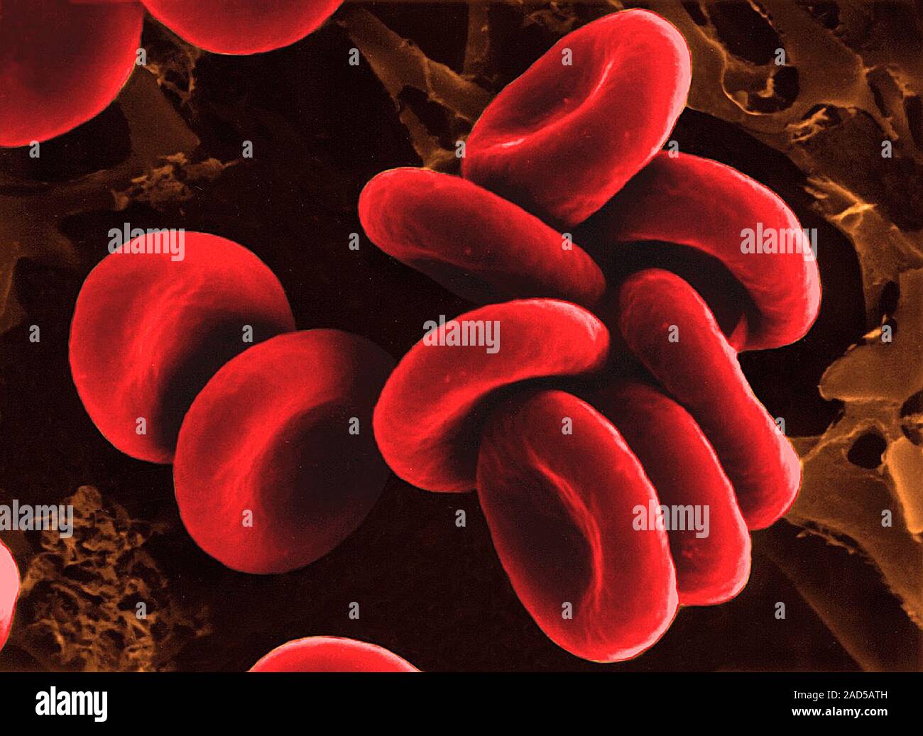 Isotonic Rbc Human red blood cells in physiological isotonic saline solution (0.9% ...