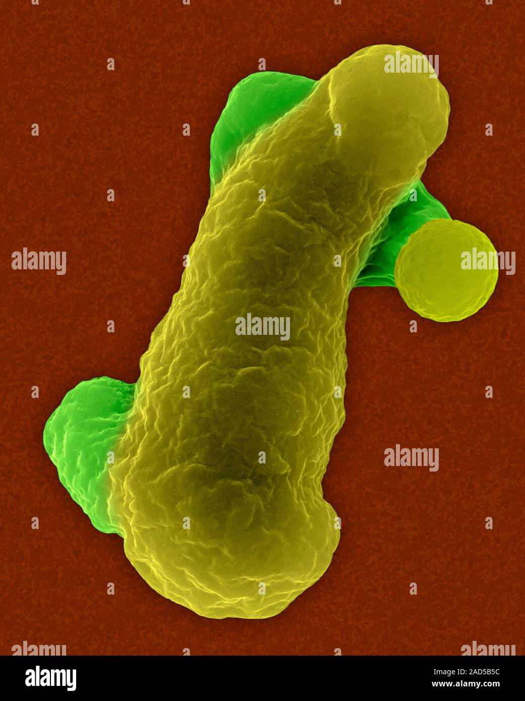 Parasitic amoeba (Entamoeba histolytica) causes amoebic dysentery ...