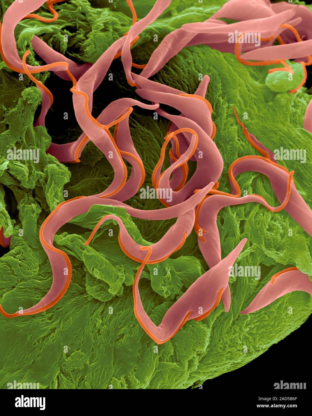 Trypanosome trypomastigote (Trypanosoma sp.), coloured scanning electron micrograph (SEM). A parasitic hemoflagellated protozoan that causes trypanoso Stock Photo