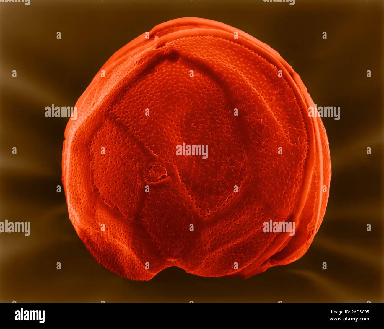 Coloured scanning electron micrograph (SEM) of Gambierdiscus toxicus is ...