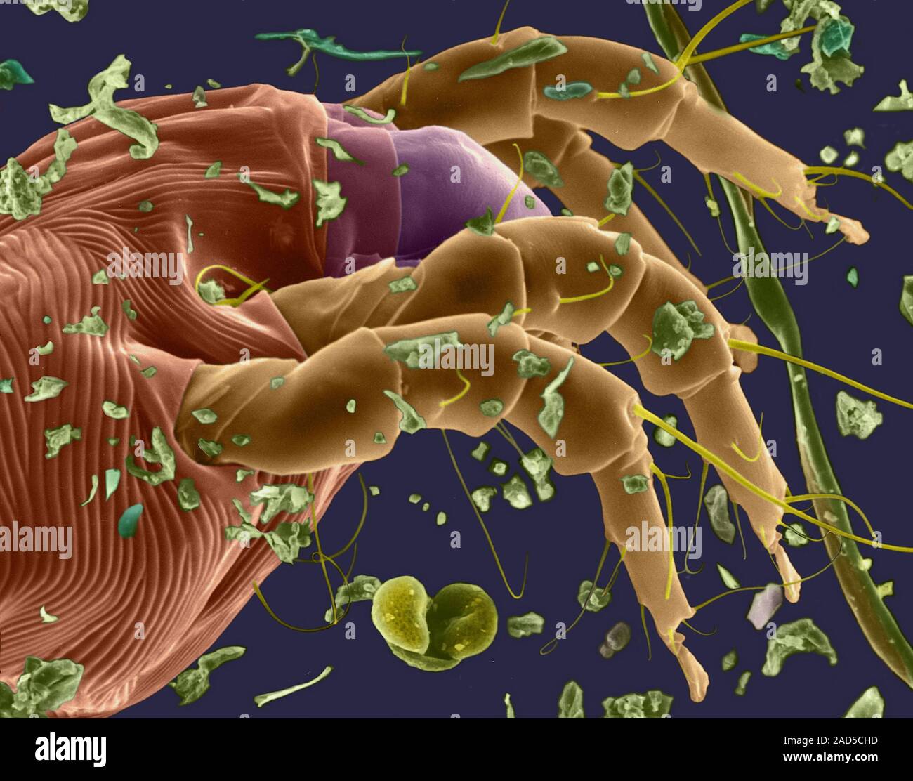 Pteronyssinus. клещ пылевой под пэмикроском. клещ dermatophagoides pteronyssinus ige. клещ dermatophagoides pteronyssinus. домашний клещ –dermatophagoides pteronyssinus.