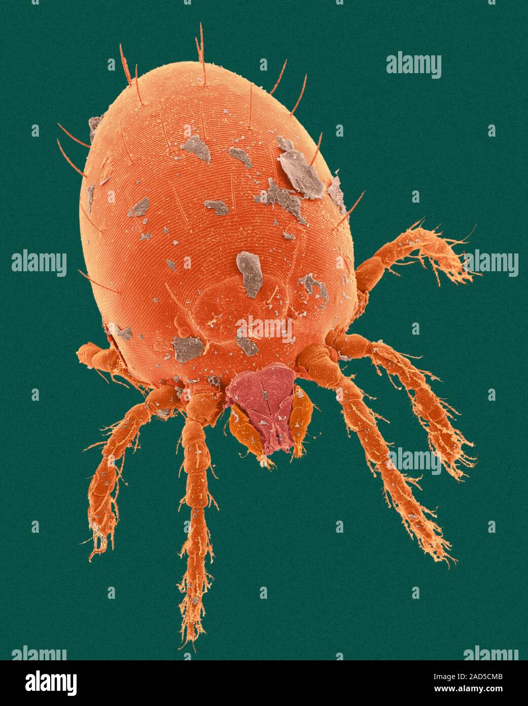 Coloured scanning electron micrograph (SEM) of Chigger (harvest mite ...