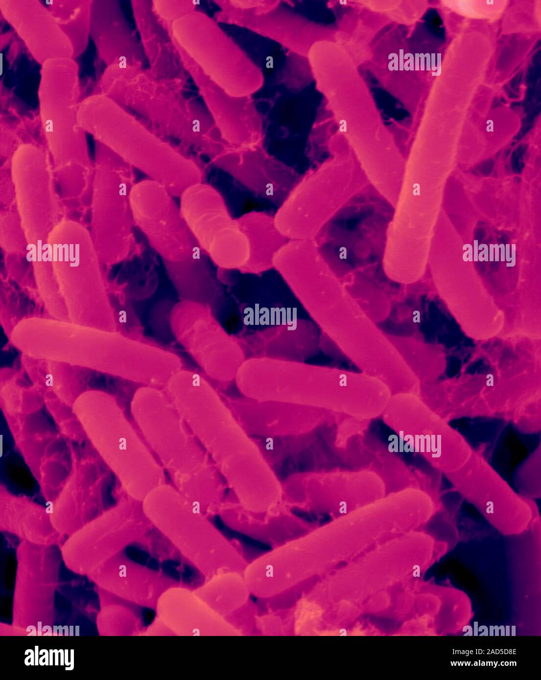 Coloured scanning electron micrograph (SEM) of Oral bacterium, Actinomyces odontolyticus. Actinomyces odontolyticus is a Gram-positive, anaerobic, fil Stock Photo