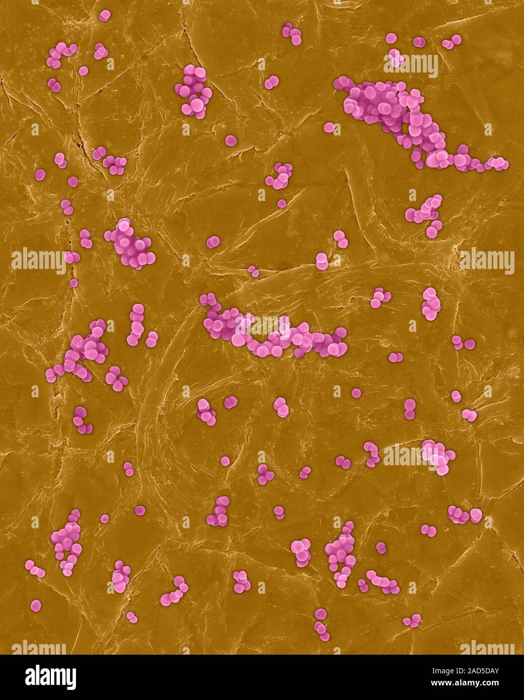 Coloured scanning electron micrograph (SEM) of