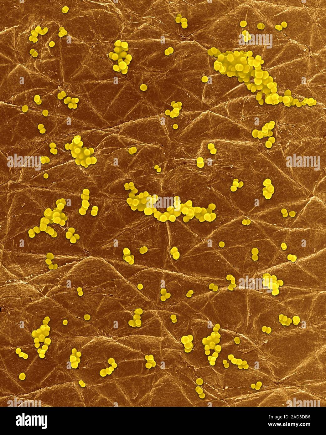 Skin Coccus Microscope Coloured scanning electron micrograph (SEM) of Photocomposite ...