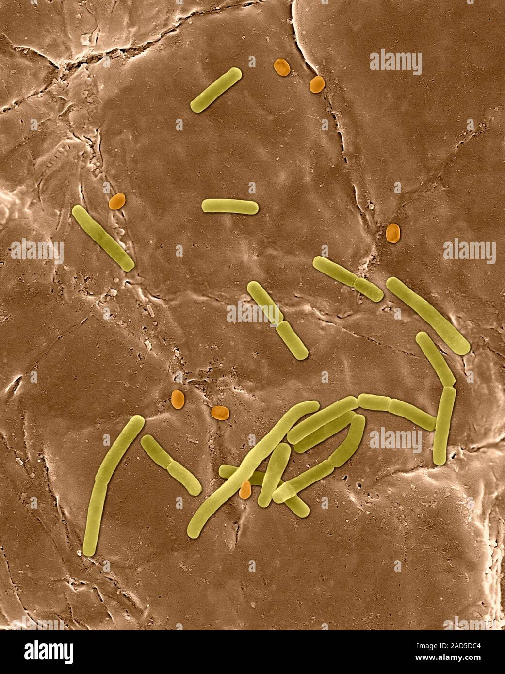 Coloured Scanning Electron Micrograph Sem Of Bacillus Anthracis Spore