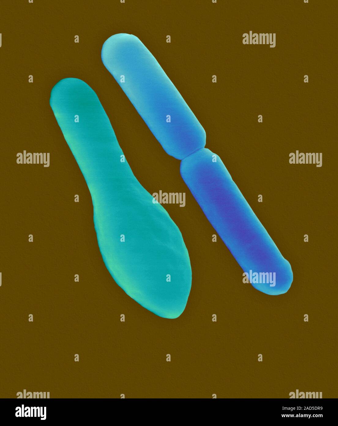 Coloured scanning electron micrograph (SEM) of Clostridium sporogenes