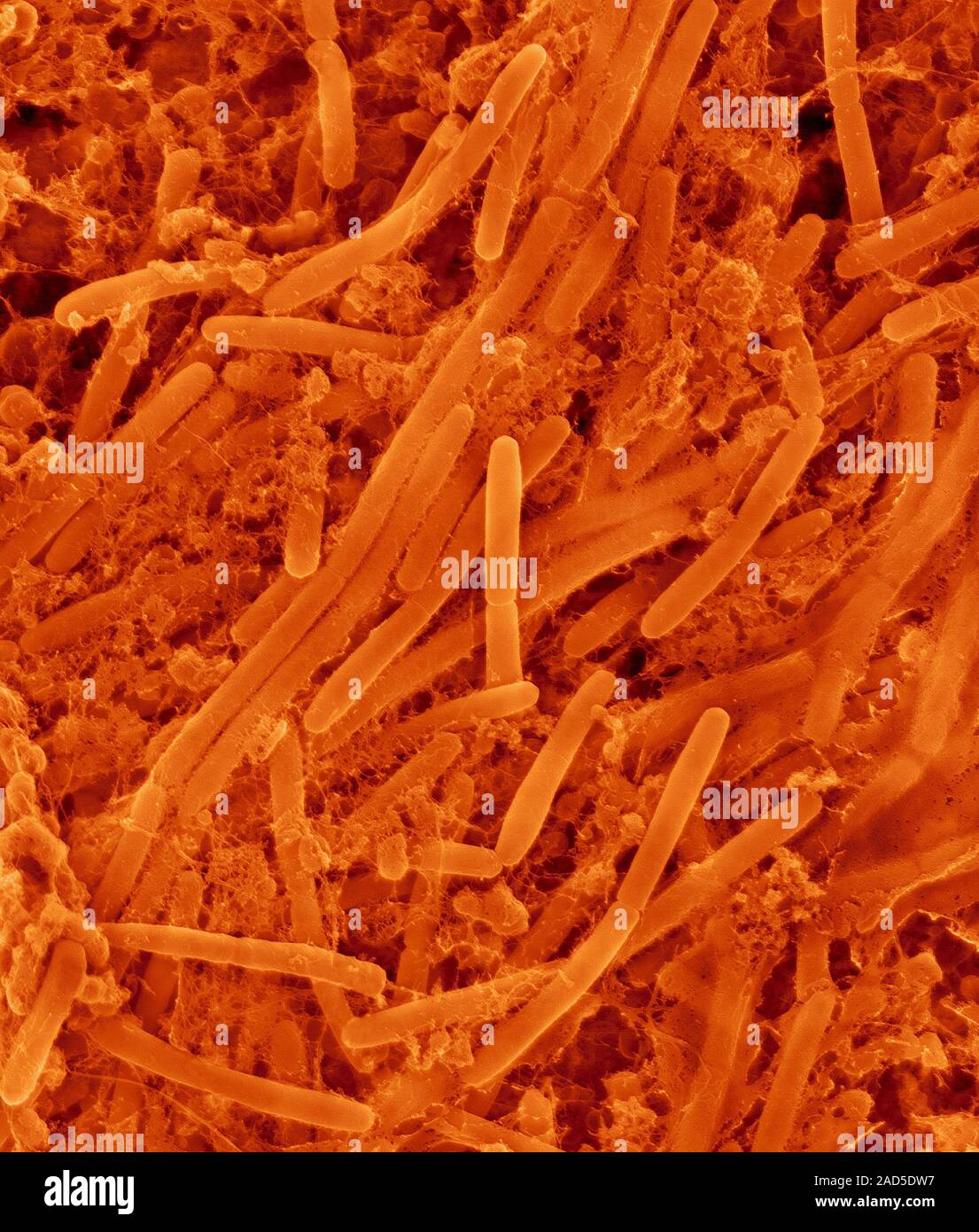 Coloured scanning electron micrograph (SEM) of Oral bacterium ...
