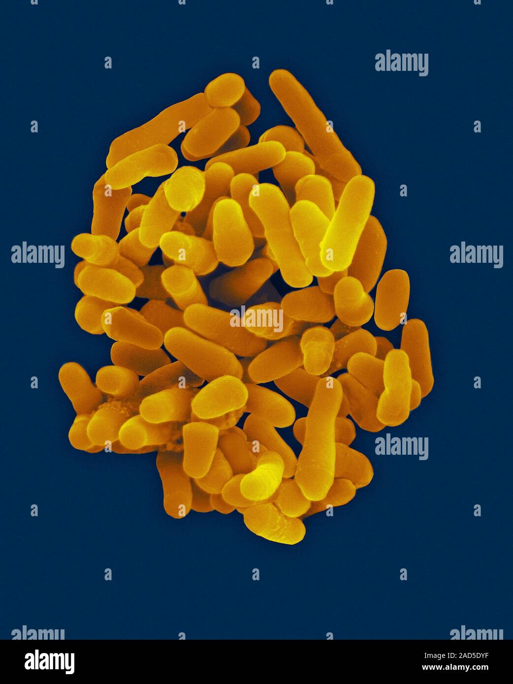 Coloured scanning electron micrograph (SEM) of Mycobacterium ...