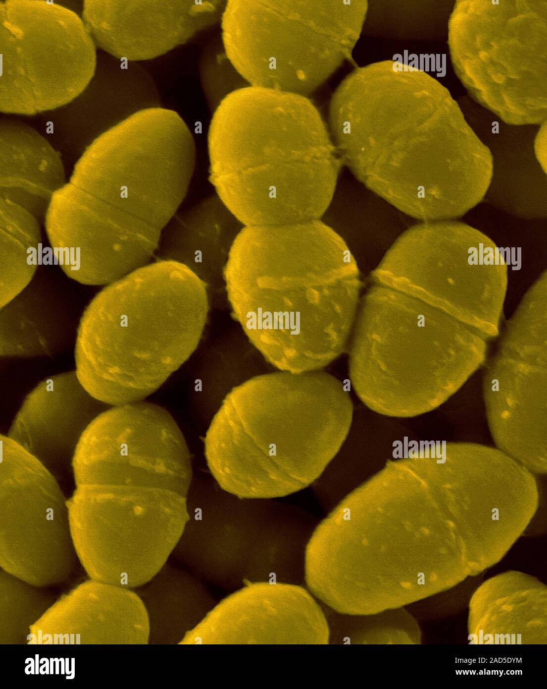 Coloured scanning electron micrograph (SEM) of Streptococcus pneumoniae ...
