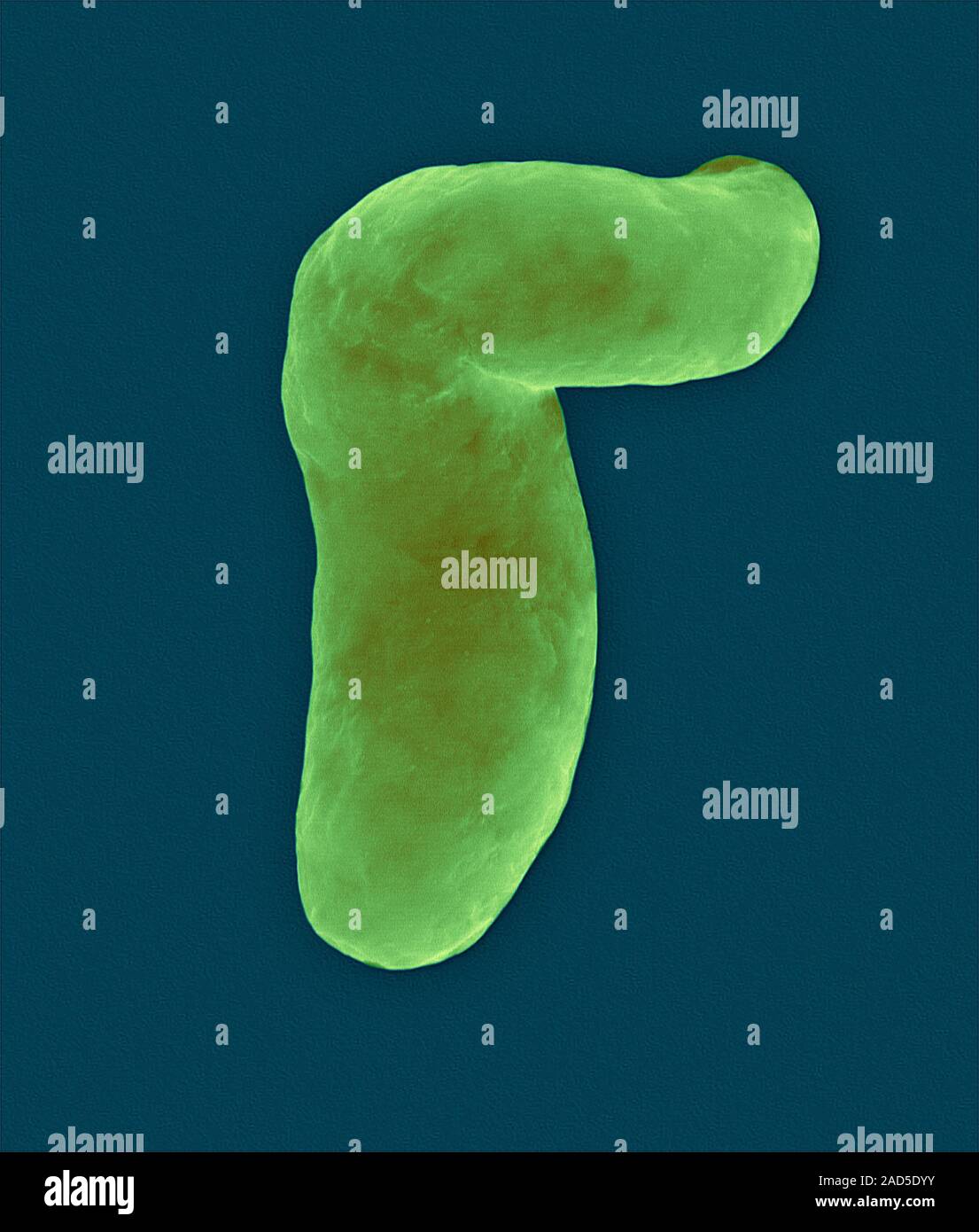 Coloured scanning electron micrograph (SEM) of Vibrio vulnificus, Gram