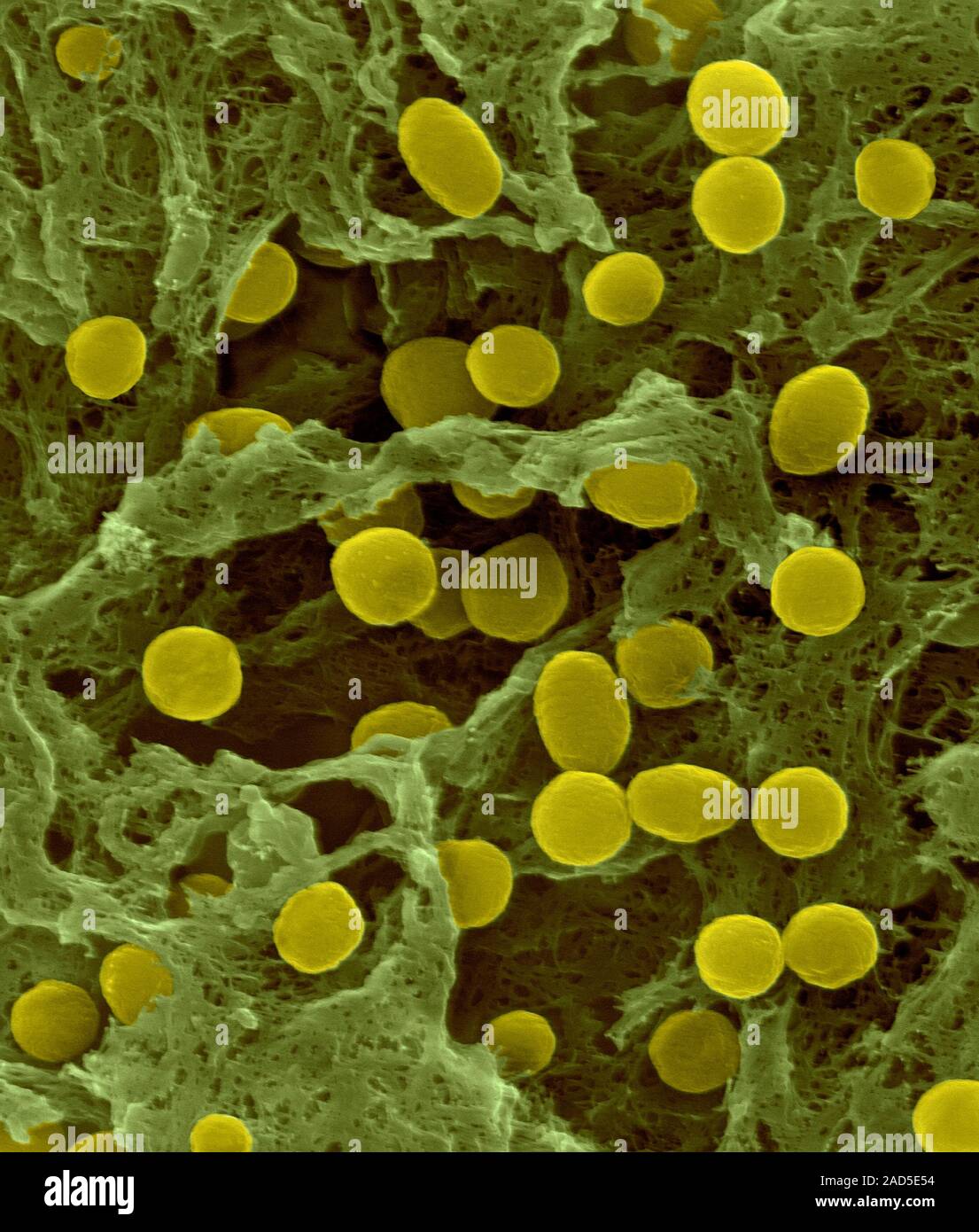 Coloured scanning electron micrograph (SEM) of Acidobacterium sp ...