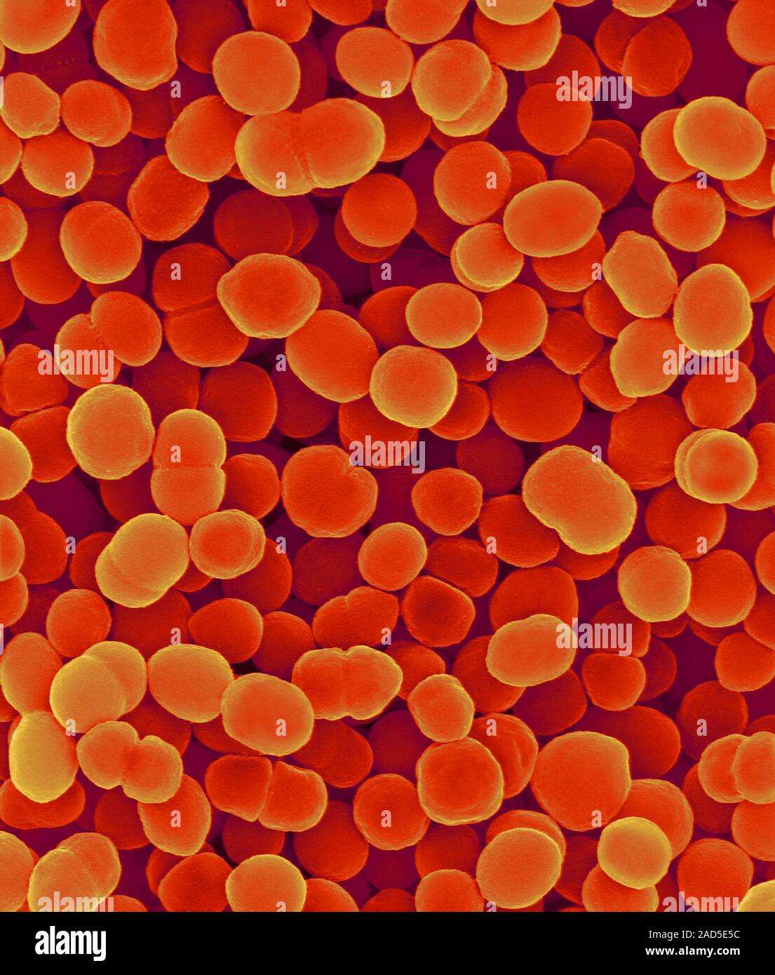 Coloured scanning electron micrograph (SEM) of Moraxella catarrhalis, gramnegative, aerobic