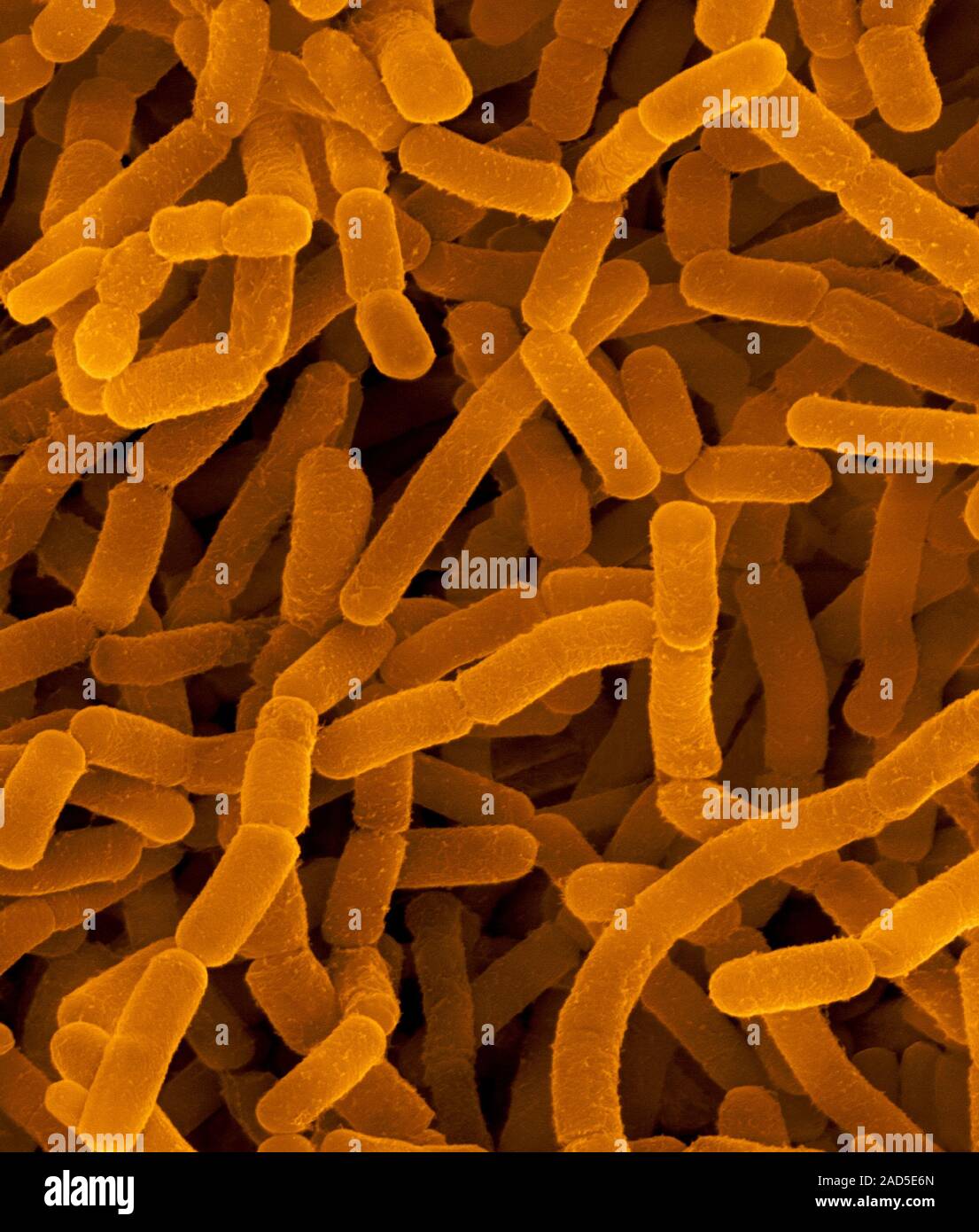 Coloured scanning electron micrograph (SEM) of Nocardia sp., Gram ...