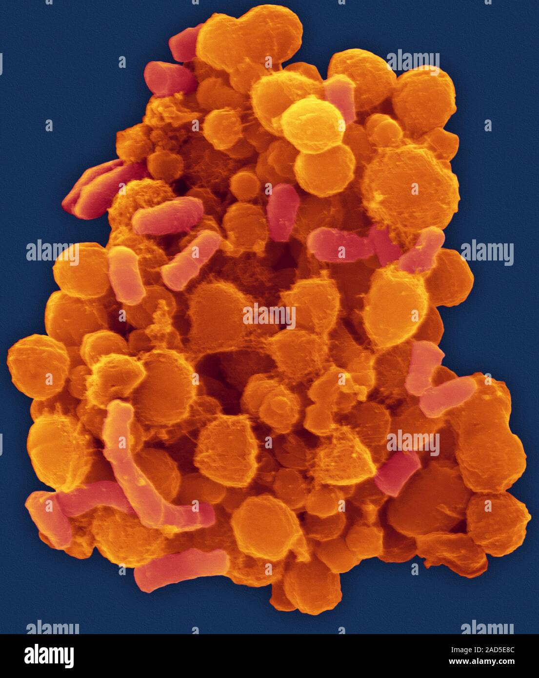 Coloured scanning electron micrograph (SEM) of Bacteria from the human ...