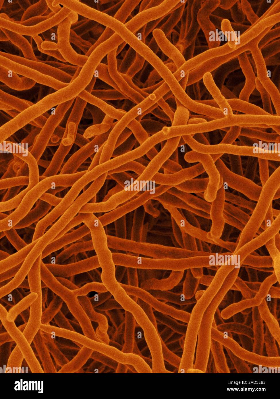 Coloured scanning electron micrograph (SEM) of Streptomyces ...