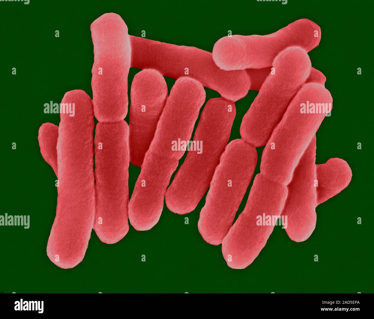 Coloured scanning electron micrograph (SEM) of Salmonella typhi is a