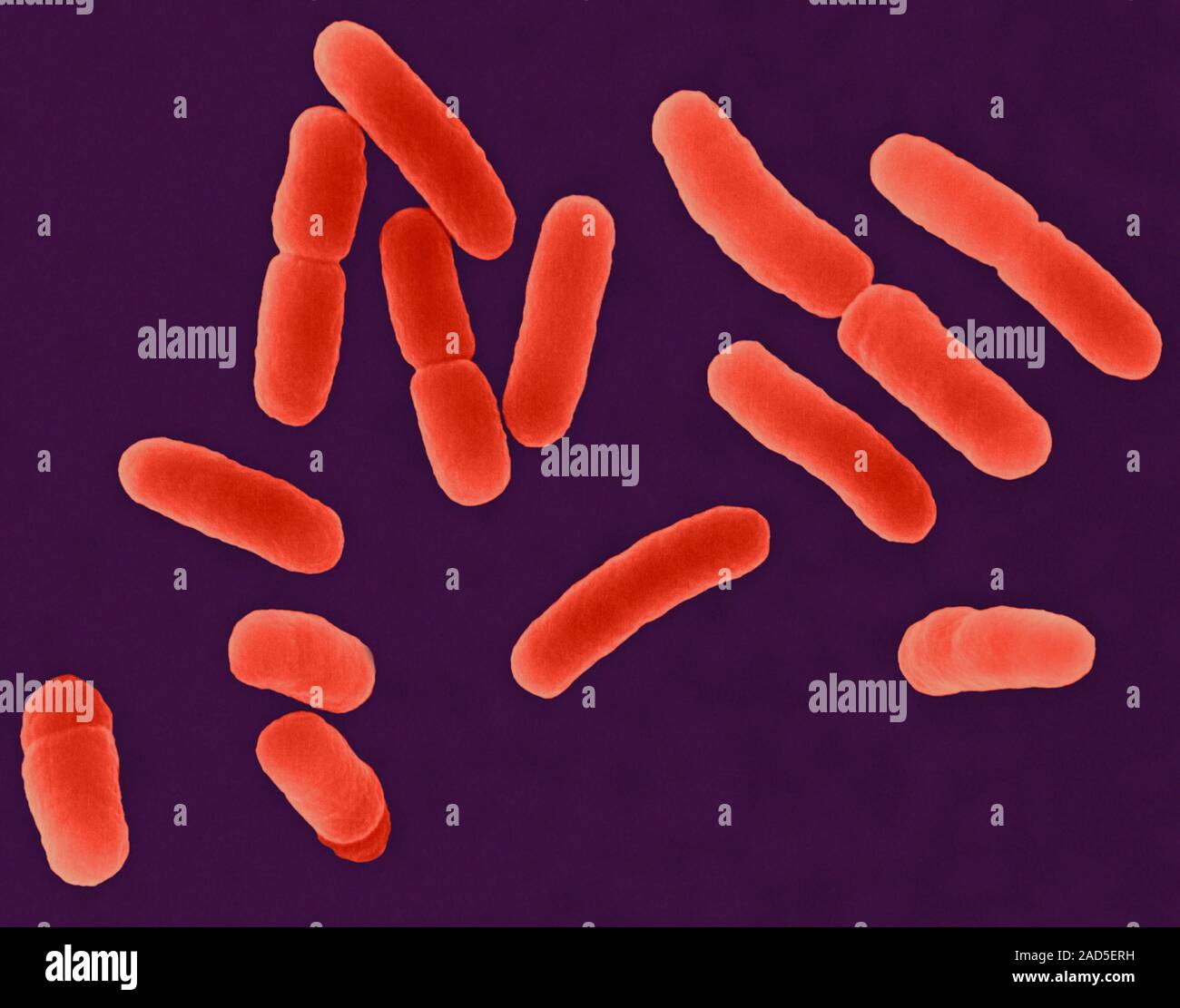 Coloured scanning electron micrograph (SEM) of E. coli (Escherichia ...