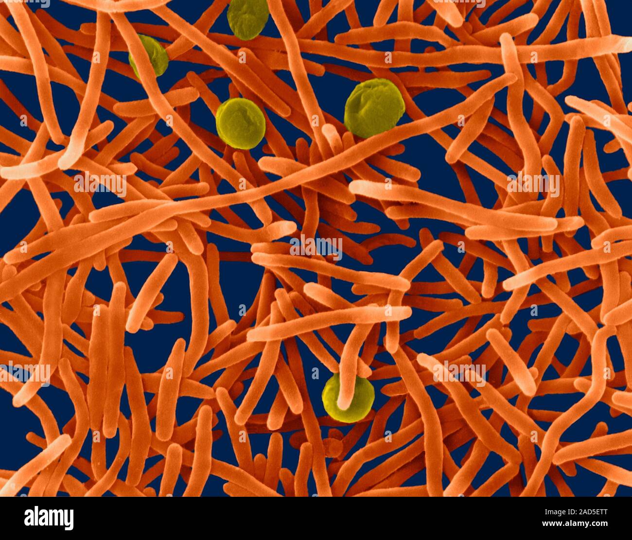 Coloured scanning electron micrograph (SEM) of Capnocytophaga ochracea ...
