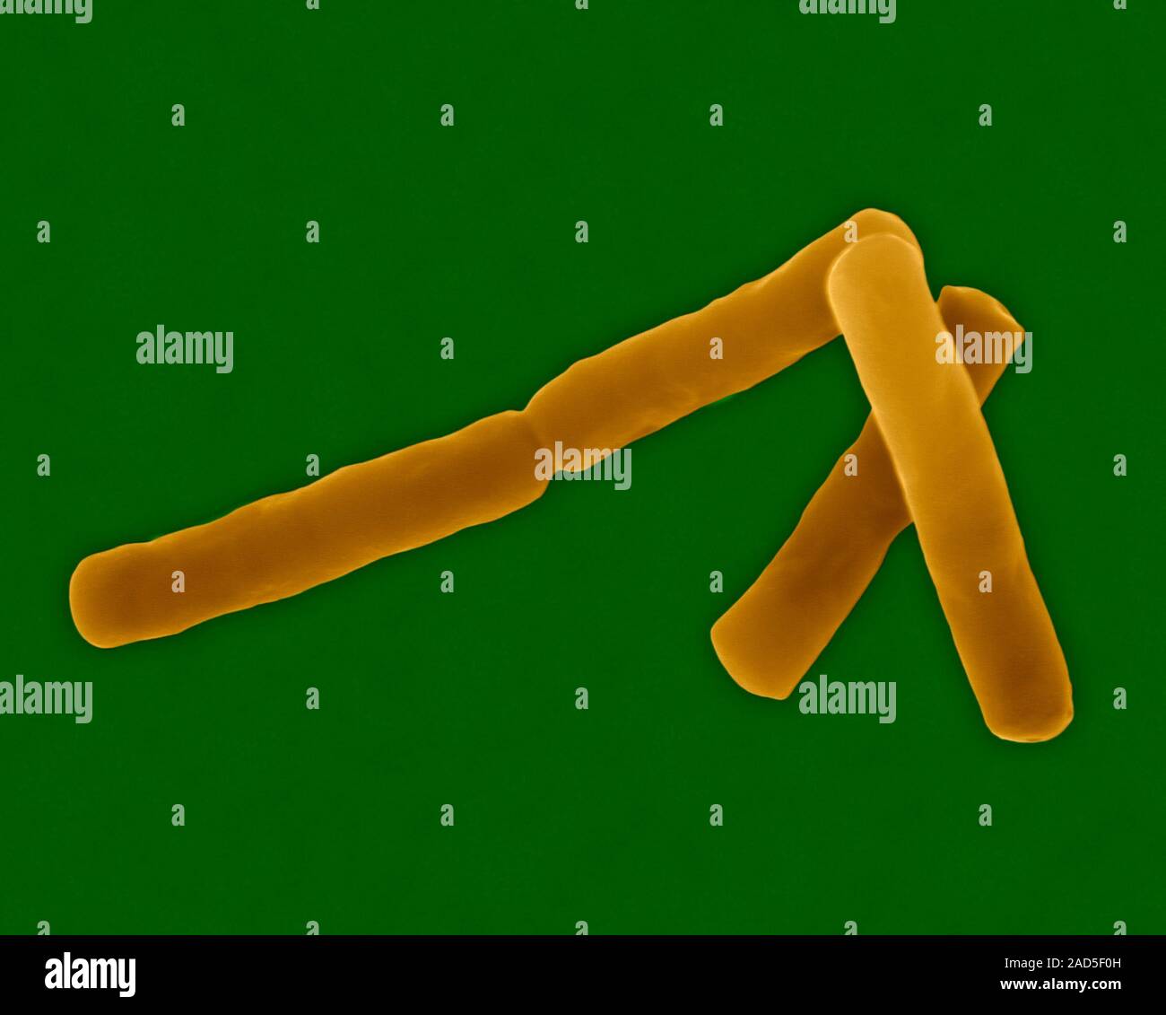 Coloured scanning electron micrograph (SEM) of Bacillus cereus, Gram ...