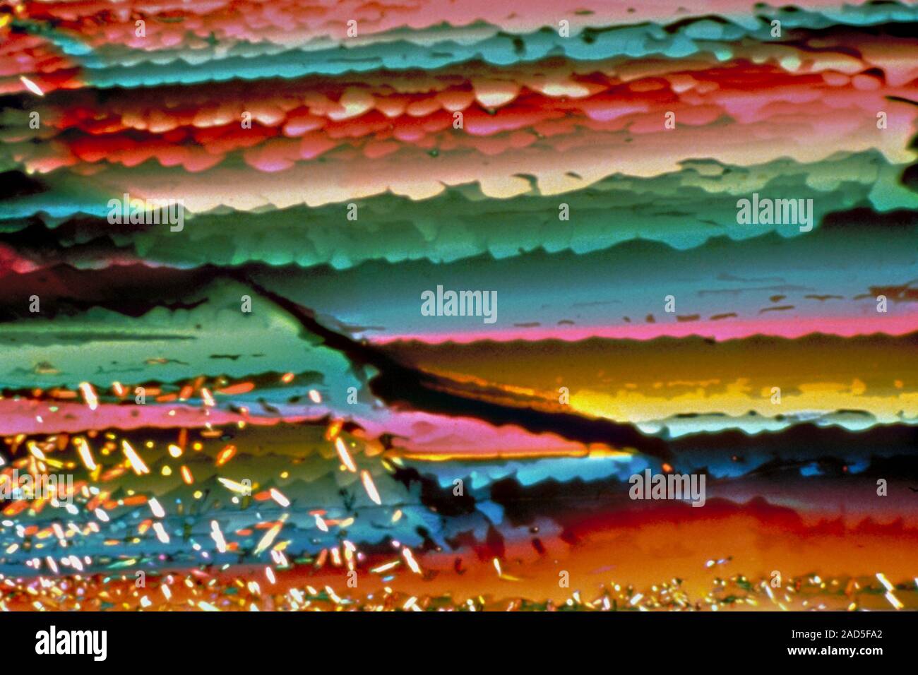 Light micrograph (LM) of Uric acid (urea) crystals. Uric acid (urea) is ...