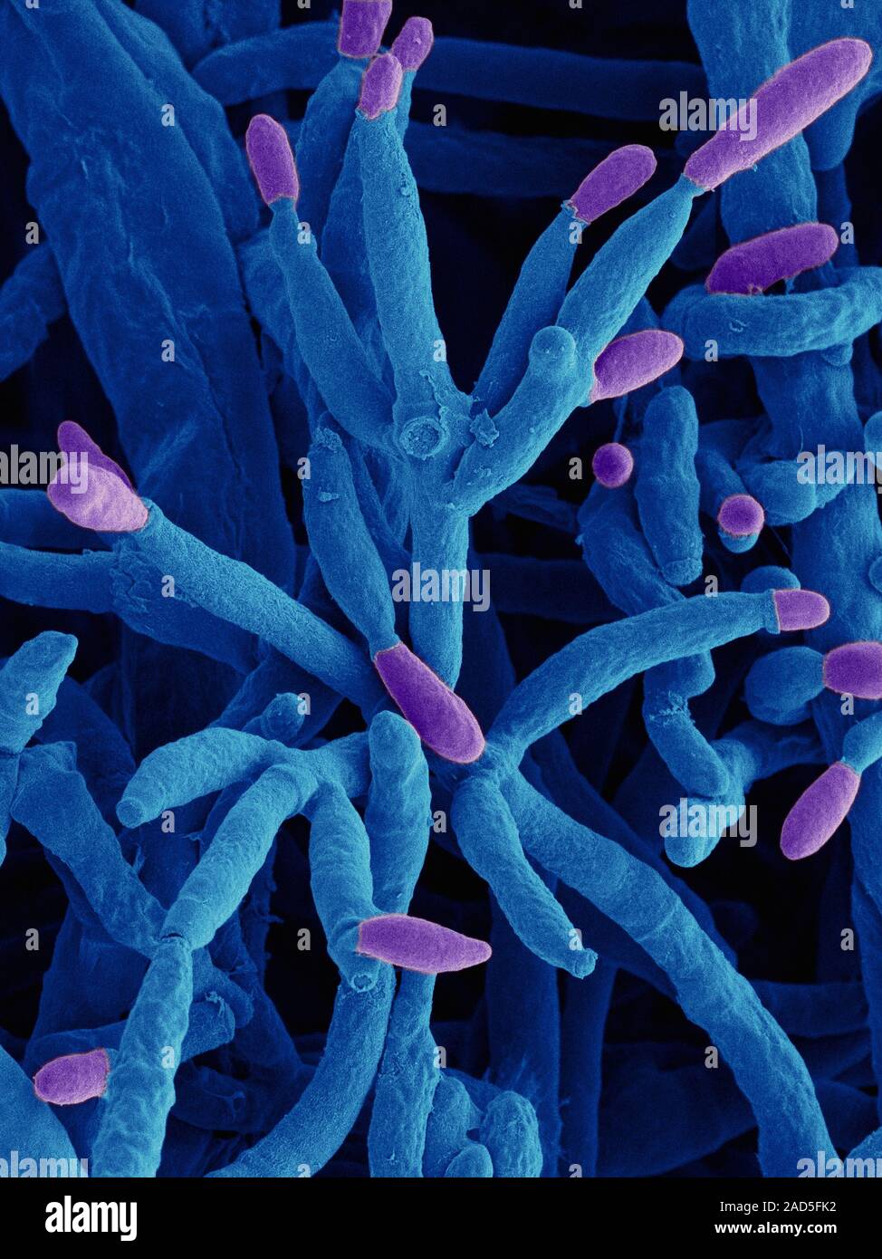 Coloured scanning electron micrograph (SEM) of Fusarium incarnatum, an ...