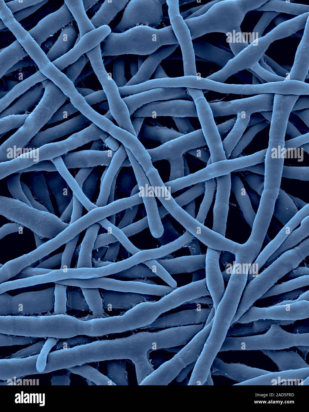 Coloured scanning electron micrograph (SEM) of Filamentous allergenic ...