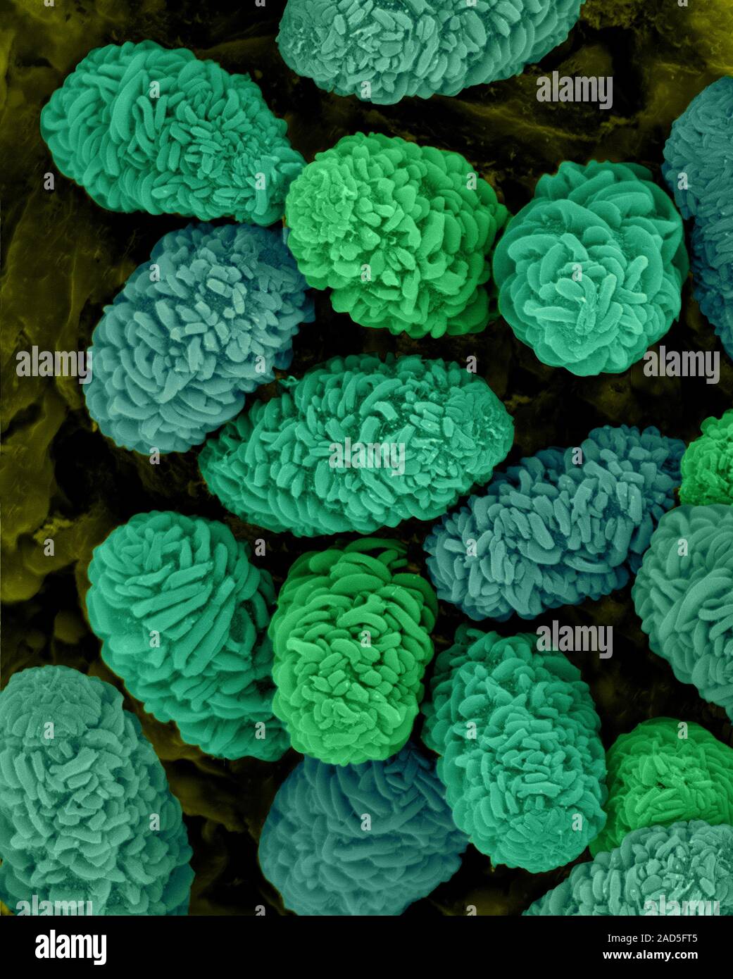Coloured scanning electron micrograph (SEM) of Toxic mould spores ...