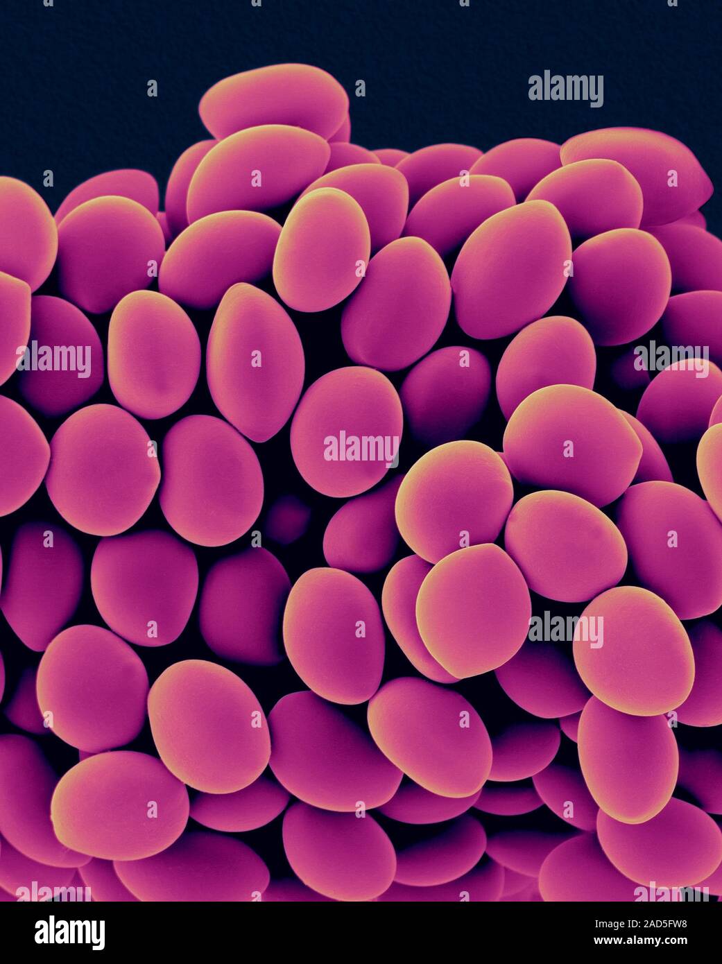 Coloured scanning electron micrograph (SEM) of Chaetomium globosum ...