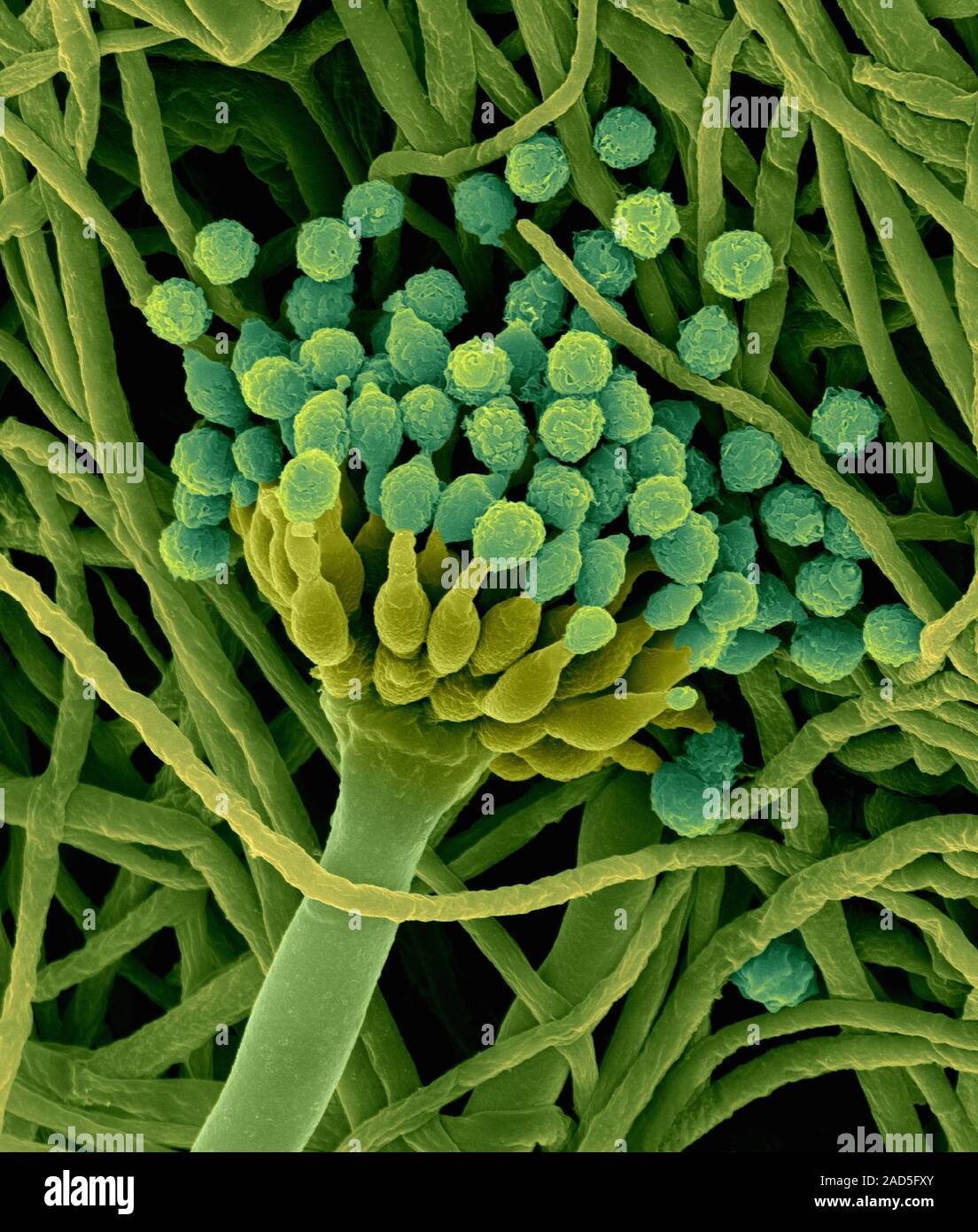 Coloured Scanning Electron Micrograph Sem Of Green Mould Hyphae And Fruiting Structure