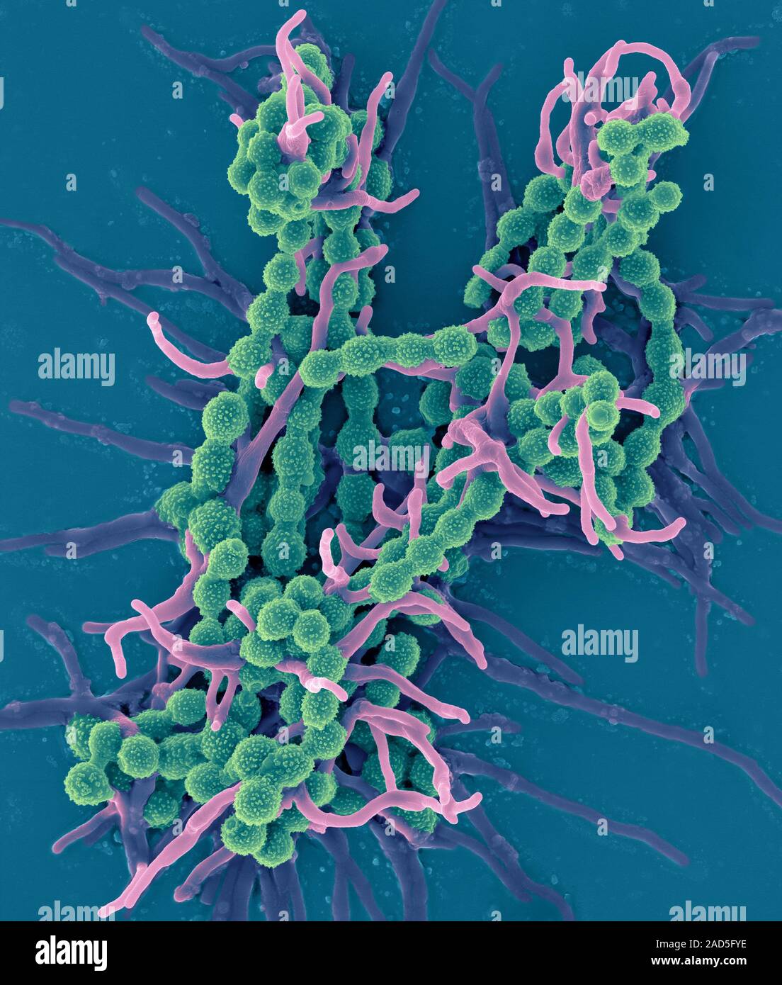 Coloured Scanning Electron Micrograph (sem) Of Hyphae And Conidia 