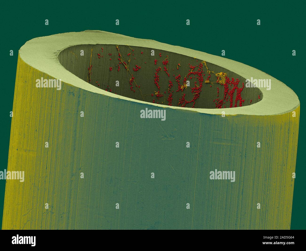 Coloured scanning electron micrograph (SEM) of Candida albicans