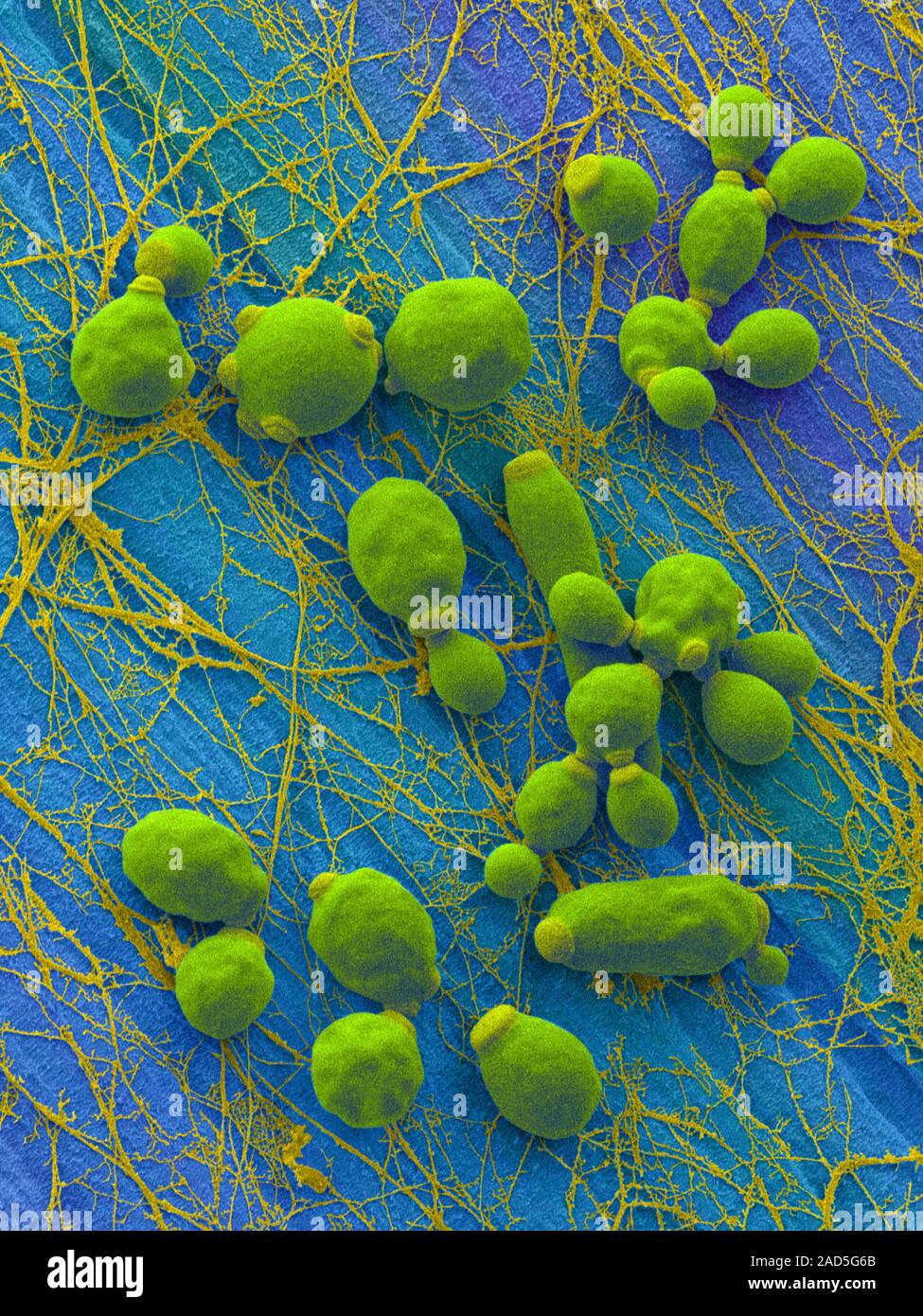 Coloured scanning electron micrograph (SEM) of Candida albicans ...